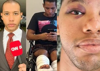 Vídeo: repórter amazonense que caiu de prédio em Brasília desabafa: ‘escolho olhar para frente’