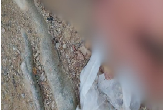 Veja: Idoso é esp@ncado até a morte, principalmente na cabeça, em rua no bairro Jorge Teixeira