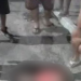 Vídeo: Mulher tem a perna arr@ncada na Compensa ao ser atropelada por motociclista