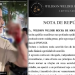 Advogado diz que PM que é segurança de bar no Centro de Manaus deu tir0 nele