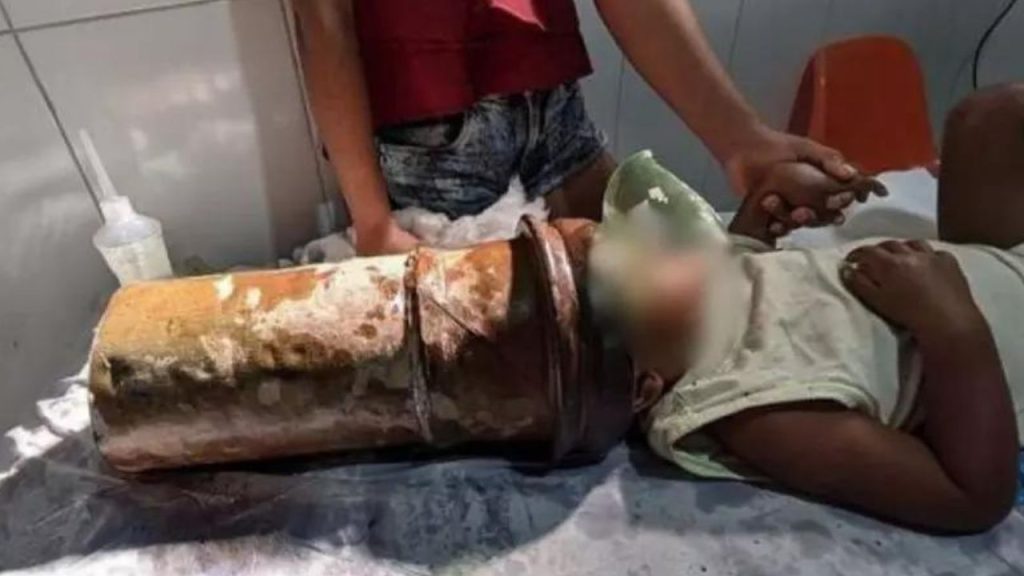 Vídeo: Menino 'quieto' de 2 anos fica com a cabeça presa em tubo de aço enquanto brincava