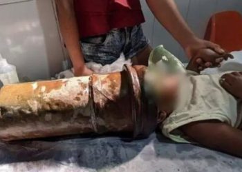 Vídeo: Menino 'quieto' de 2 anos fica com a cabeça presa em tubo de aço enquanto brincava