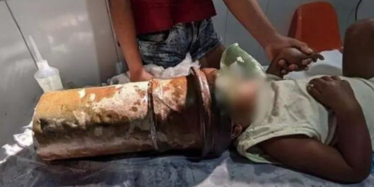 Vídeo: Menino 'quieto' de 2 anos fica com a cabeça presa em tubo de aço enquanto brincava