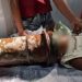 Vídeo: Menino 'quieto' de 2 anos fica com a cabeça presa em tubo de aço enquanto brincava