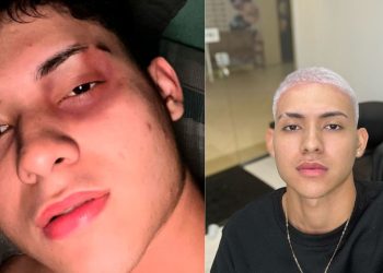 Influenciador de Manaus acusa PM de agressão durante namoro: "As agressões começaram com aperto de mão"