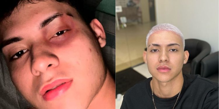 Influenciador de Manaus acusa PM de agressão durante namoro: "As agressões começaram com aperto de mão"
