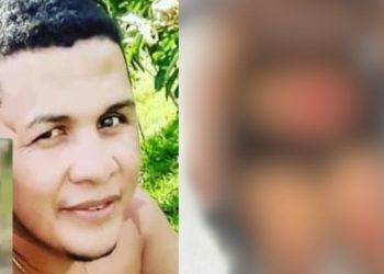 Mulher fica toda ralada em acidente de moto ocasionado pelo ex em Manacapuru; imagem forte