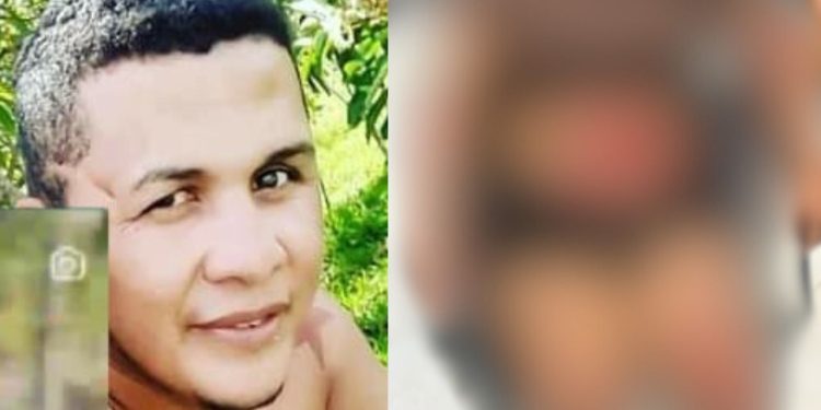 Mulher fica toda ralada em acidente de moto ocasionado pelo ex em Manacapuru; imagem forte