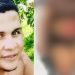 Mulher fica toda ralada em acidente de moto ocasionado pelo ex em Manacapuru; imagem forte