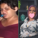 Buiú do Coroado recupera dentes após vício em drogas e mostra novo sorriso; veja