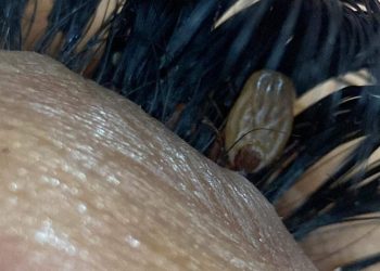 Bizarro: Carrapato é descoberto em extensão de cílios de cliente em salão de beleza