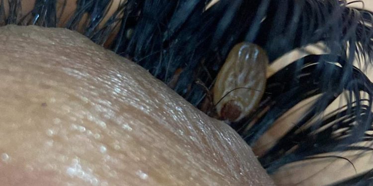 Bizarro: Carrapato é descoberto em extensão de cílios de cliente em salão de beleza