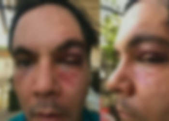 Família pede justiça após autista ser confundido com ladrão e espancado em Manaus