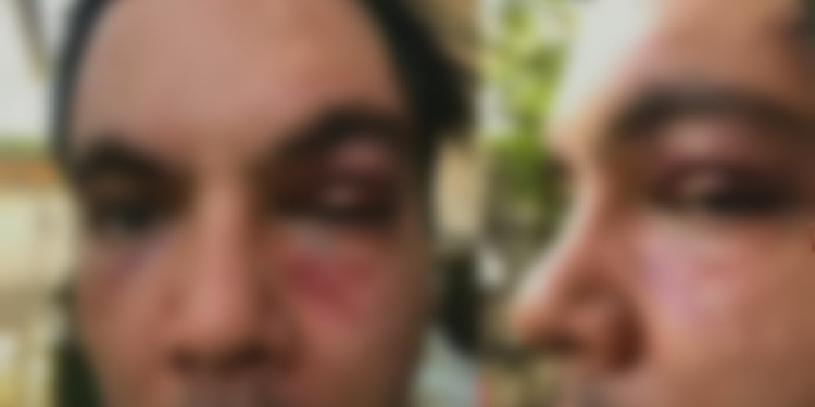 Família pede justiça após autista ser confundido com ladrão e espancado em Manaus