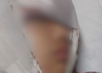 Veja: Menina fica com o cabelo preso em brinquedo e tem o couro cabelo arrancado