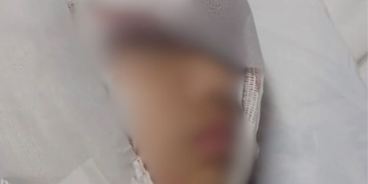 Veja: Menina fica com o cabelo preso em brinquedo e tem o couro cabelo arrancado