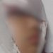 Veja: Menina fica com o cabelo preso em brinquedo e tem o couro cabelo arrancado