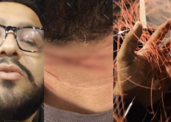 Vídeo: Jornalista de Manaus relata livramento ao ter o pescoço cortado por linha com cerol em Manaus