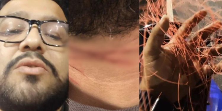 Vídeo: Jornalista de Manaus relata livramento ao ter o pescoço cortado por linha com cerol em Manaus