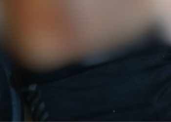 IMAGEM FORTE: Mulher fica baleada durante execução de homem na zona norte de Manaus