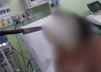 Caso bizarro: Em Manaus, mulher entra no hospital normalmente com faca cravada na cabeça