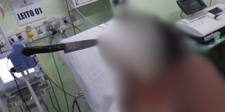 Caso bizarro: Em Manaus, mulher entra no hospital normalmente com faca cravada na cabeça