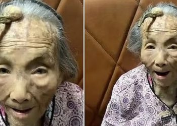 Idosa de 107 anos exibe protuberância na testa e fica famosa do TikTok: ‘chifre da longevidade’