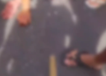 Vídeo: Jovem s0fre fratur@ exposta em acidente de moto na Zona Norte de Manaus