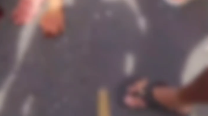 Vídeo: Jovem s0fre fratur@ exposta em acidente de moto na Zona Norte de Manaus