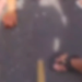 Vídeo: Jovem s0fre fratur@ exposta em acidente de moto na Zona Norte de Manaus