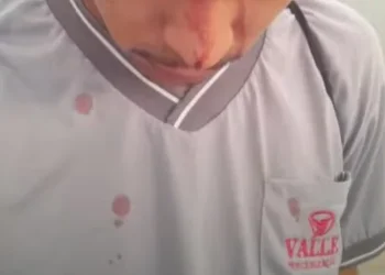 Em rota do Distrito Industrial, trabalhador leva c0r0nhada$ durante assalto