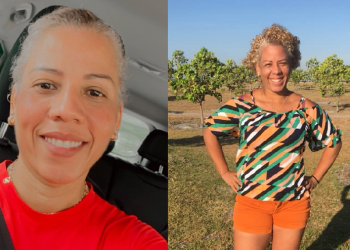 ‘Choque’, diz amiga de mulher m0rt@ após cirurgia plástica em Manaus