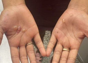 Mulher é presa por t0rturar menina de 12 anos com socos e queimaduras em Manaus