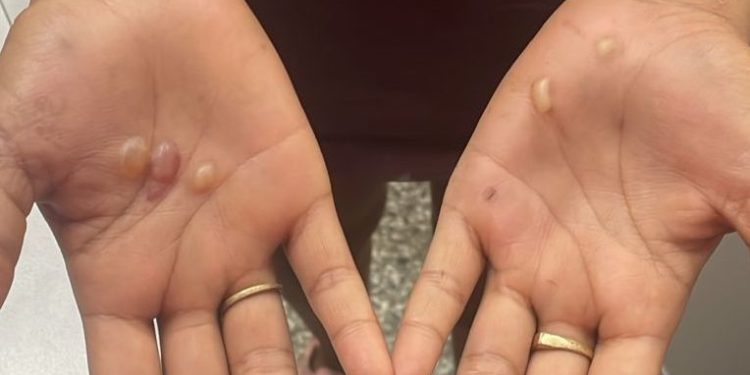 Mulher é presa por t0rturar menina de 12 anos com socos e queimaduras em Manaus