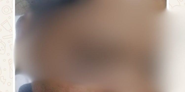 Mulher sai para denunciar o marido após ser agredida e termina presa; entenda