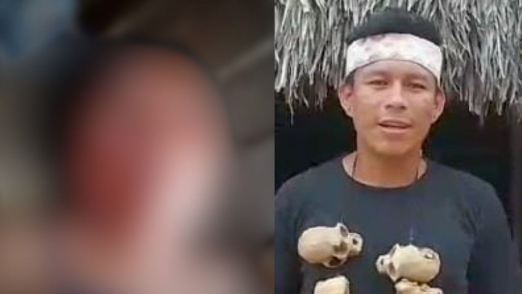 Indígena tem olho arranc@do pelo marido durante discussão por ‘ciúmes’ no interior do Amazonas