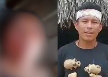 Indígena tem olho arranc@do pelo marido durante discussão por ‘ciúmes’ no interior do Amazonas