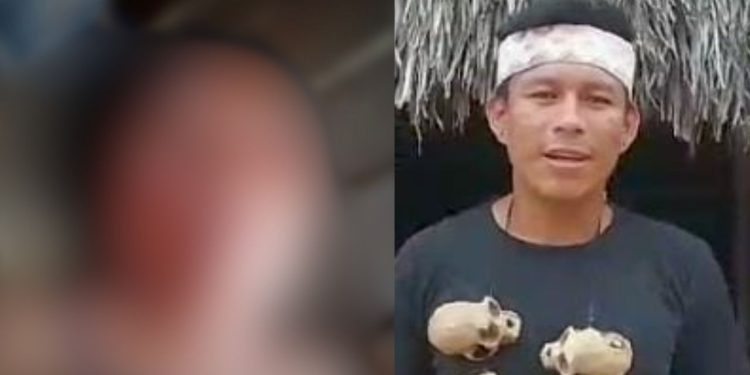 Indígena tem olho arranc@do pelo marido durante discussão por ‘ciúmes’ no interior do Amazonas