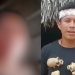 Indígena tem olho arranc@do pelo marido durante discussão por ‘ciúmes’ no interior do Amazonas
