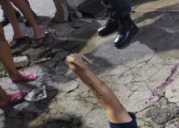 Veja: Andando na Compensa, homem sofre tentativa de h0micídi0 e pega três balaços