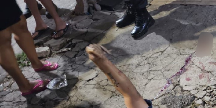 Veja: Andando na Compensa, homem sofre tentativa de h0micídi0 e pega três balaços