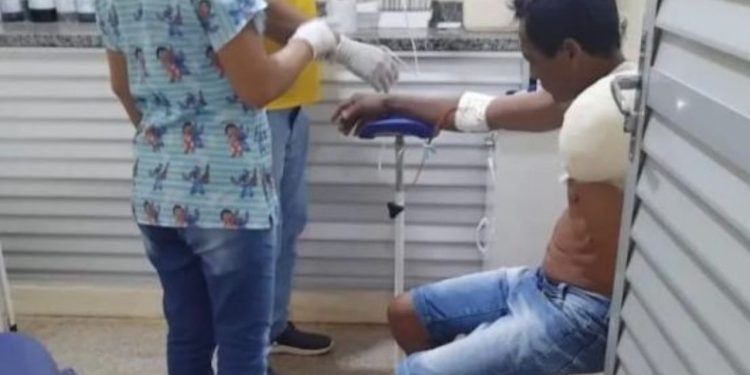 Pescador fica sem o braço após mordida de jacaré no interior do Amazonas