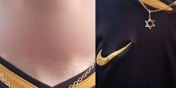 Motociclista faz alerta aos colegas após linha com cerol quase c0rtar o seu pescoço na Cosme Ferreira