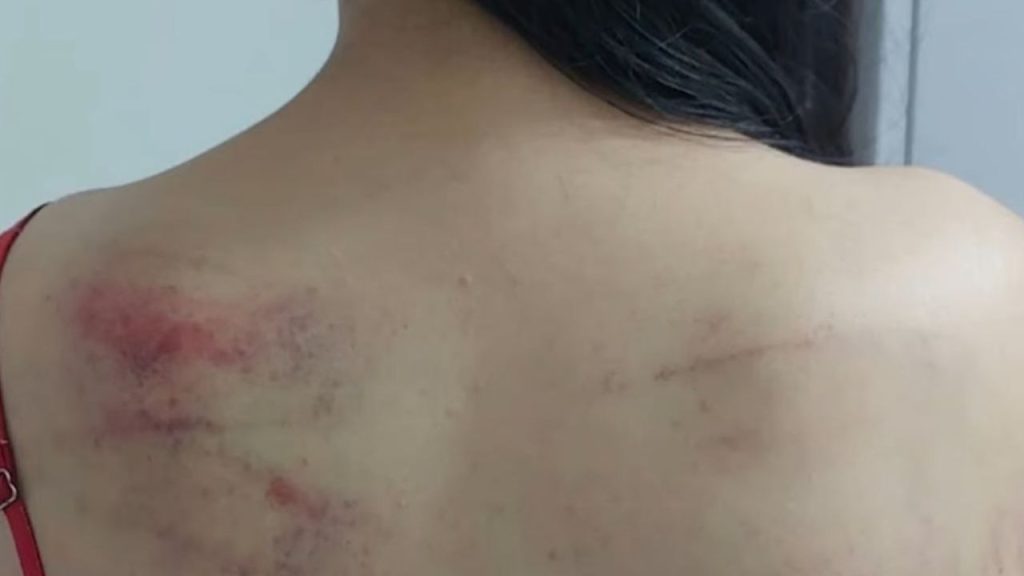 Em Manaus, menina de 10 anos vai ao Conselho Tutelar cheio de hematomas após apanhar da mãe