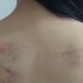 Em Manaus, menina de 10 anos vai ao Conselho Tutelar cheio de hematomas após apanhar da mãe