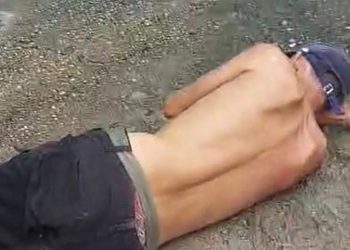 Vídeo forte: homem tem o pé destruíd0 após ser atingido por catolé em Manaus