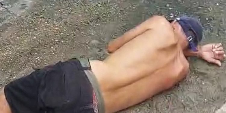 Vídeo forte: homem tem o pé destruíd0 após ser atingido por catolé em Manaus