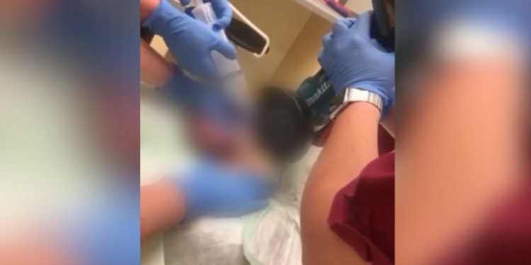 Vídeo: marido é operado após esposa prender seus testícul0s com algemas