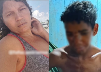 Vídeo: Madrasta é presa após jogar água quente no rosto do enteado com deficiência intelectual