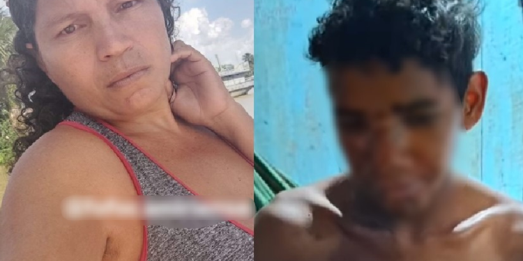 Vídeo: Madrasta é presa após jogar água quente no rosto do enteado com deficiência intelectual